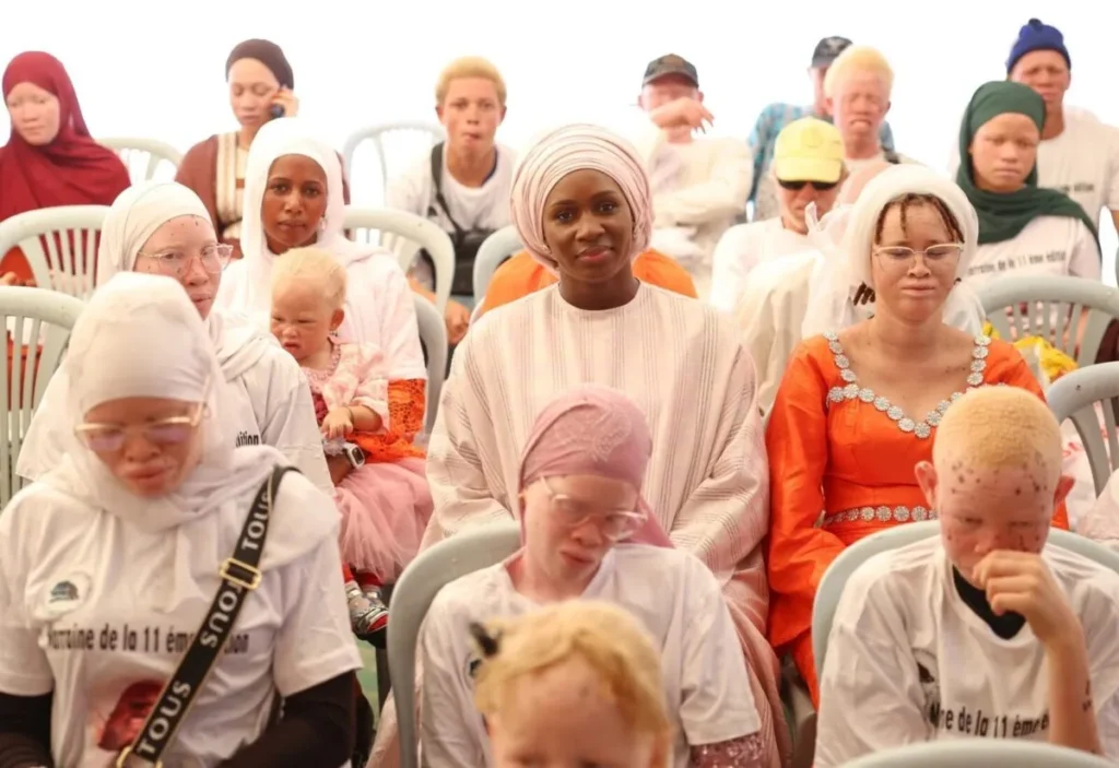 Marie Khone Faye : « Un enfant albinos a le droit d’apprendre sans être moqué »