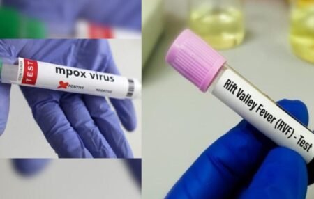 Fièvre de la Vallée du Rift et Mpox: 229 cas enregistrés